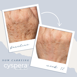 Cyspera Intensive Pigment Corrector & Boost Brightening Booster Cream Duo (2-Piece Set)