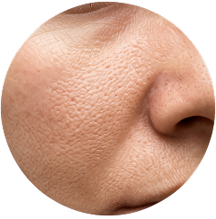 Large Pores