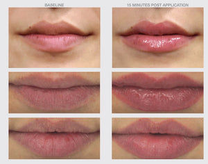 Before and after lip results showing fuller hydrated lips after using NazarianSkin Lip Boost plumping serum