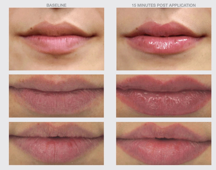 Before and after lip results showing fuller hydrated lips after using NazarianSkin Lip Boost plumping serum