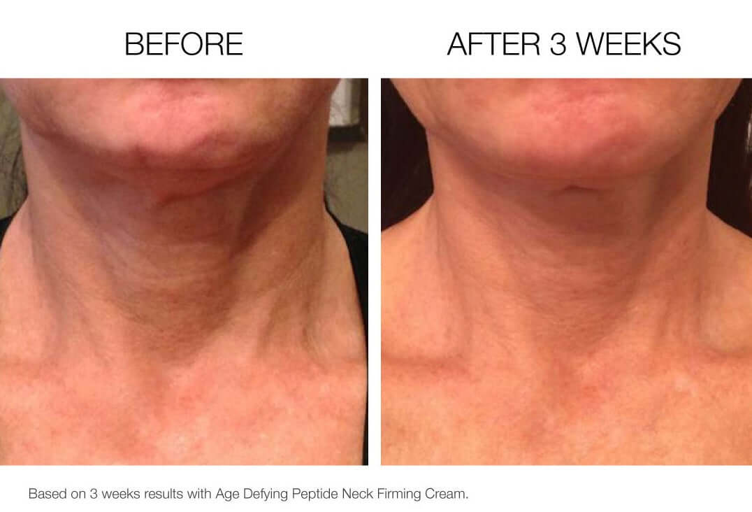 Before and after results using firming neck cream showing improved neck firmness and smoother skin after 3 weeks