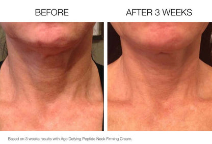 Before and after results using firming neck cream showing improved neck firmness and smoother skin after 3 weeks