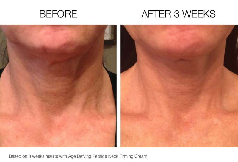 Peptide Rich Hydrating Firming Neck Cream-The Skin Spot