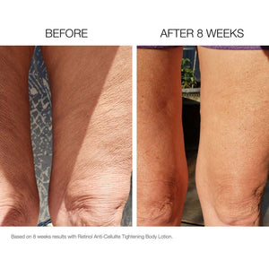 Smooth Body Toning, Firming Antiox Lotion-The Skin Spot