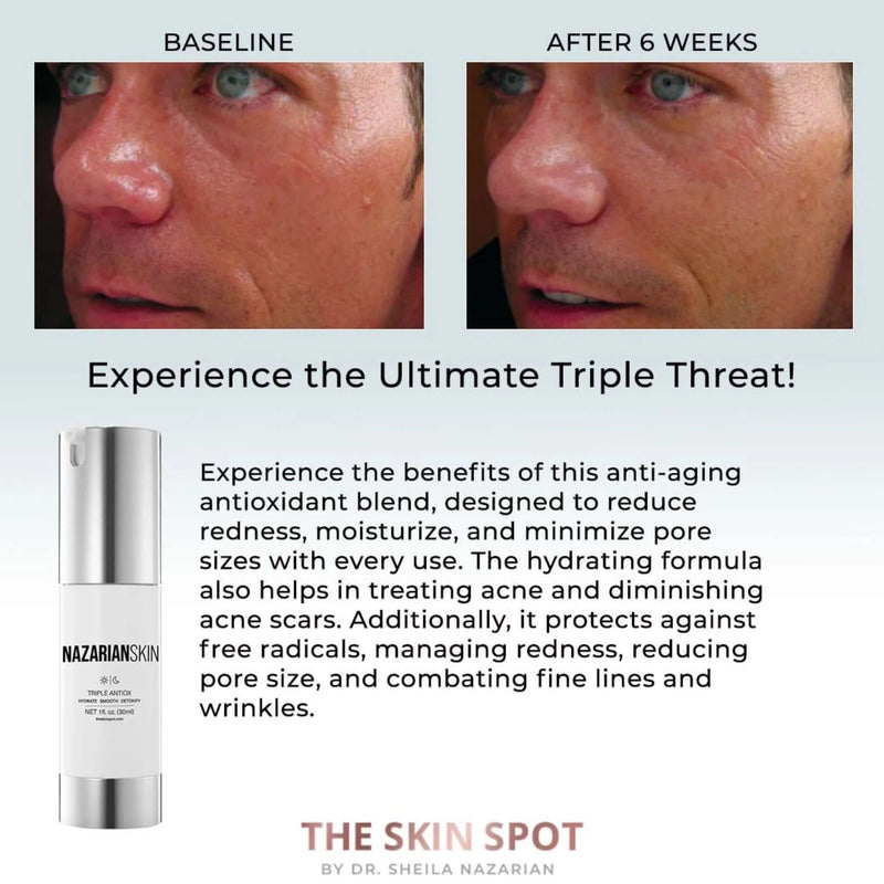 NazarianSkin Triple AntiOx: Reduce Redness + Calm + Anti Age – The NazarianSkin Triple AntiOx: Reduce Redness + Calm + Anti Age – The