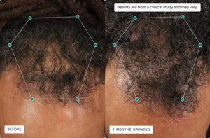 Nutrafol- Core For Men-The Skin Spot