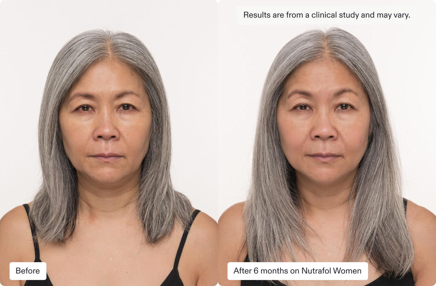 Before and after 6 months on Nutrafol Core for Women, showing improved hair fullness and texture in an Asian woman.