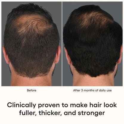 ( plated ) HAIR Serum before and after 3 months shows fuller, thicker-looking hair with daily Renewosome scalp serum use..