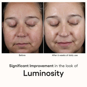 ( plated ) INTENSE Serum before and after 6 weeks shows brighter luminosity, radiant glow, and smoother-looking facial skin.