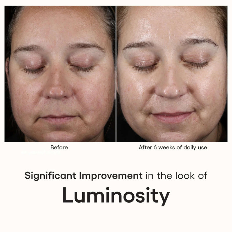 ( plated ) INTENSE Serum before and after 6 weeks shows brighter luminosity, radiant glow, and smoother-looking facial skin.