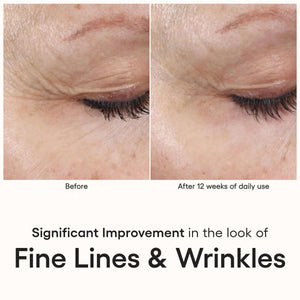 ( plated ) INTENSE Serum before and after 12 weeks shows eye fine lines and wrinkles with smoother-looking skin texture use.