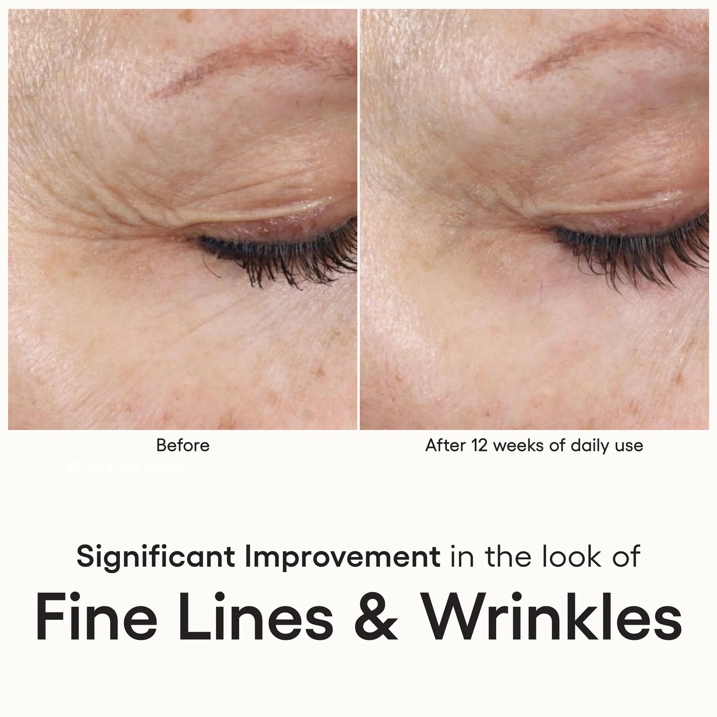 Before and after 12 weeks of daily use of Plated Skin Science INTENSE Serum, significant reduction in fine lines and wrinkles