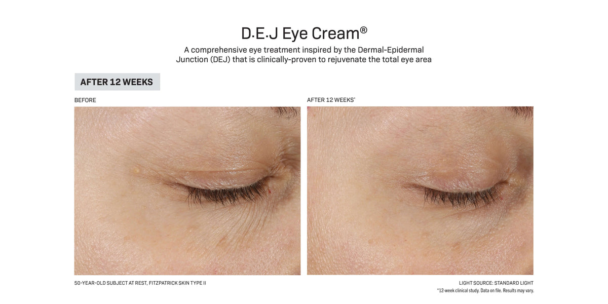 Before and after eyelid smoothing results using Revision Skincare D·E·J Eye Cream after 12 weeks of use