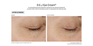Revision Skincare- DEJ Eye-The Skin Spot