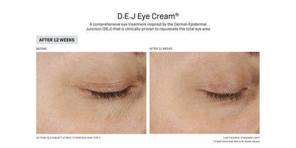 Before and after using Revision Skincare DEJ Eye Cream, 12-week results showing reduced fine lines and improved skin texture