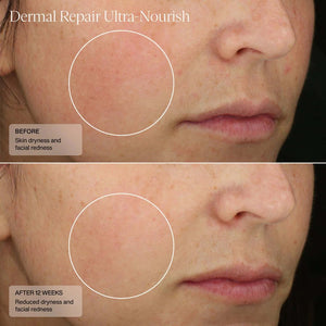 Sente- Dermal Repair Ultra-Nourish-The Skin Spot