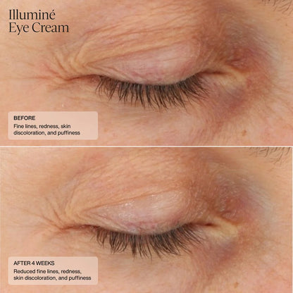 Before and after using SENTÉ Illumine Eye Cream, 4-week results showing reduced fine lines