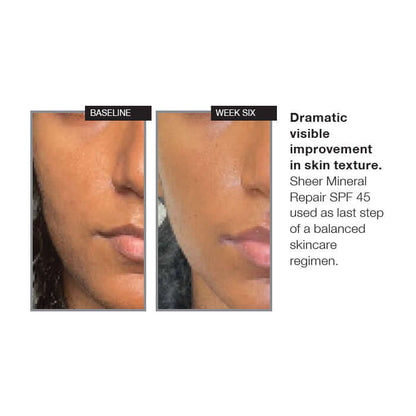NazarianSkin Sheer Mineral SPF 45 sunscreen before and after 6 weeks showing visible skin texture improvement and smoother skin