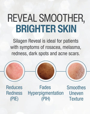 Silagen Reveal graphic for smoother brighter skin, redness, hyperpigmentation, dark spots, and acne scar texture