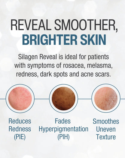 Silagen Reveal graphic for smoother brighter skin, redness, hyperpigmentation, dark spots, and acne scar texture