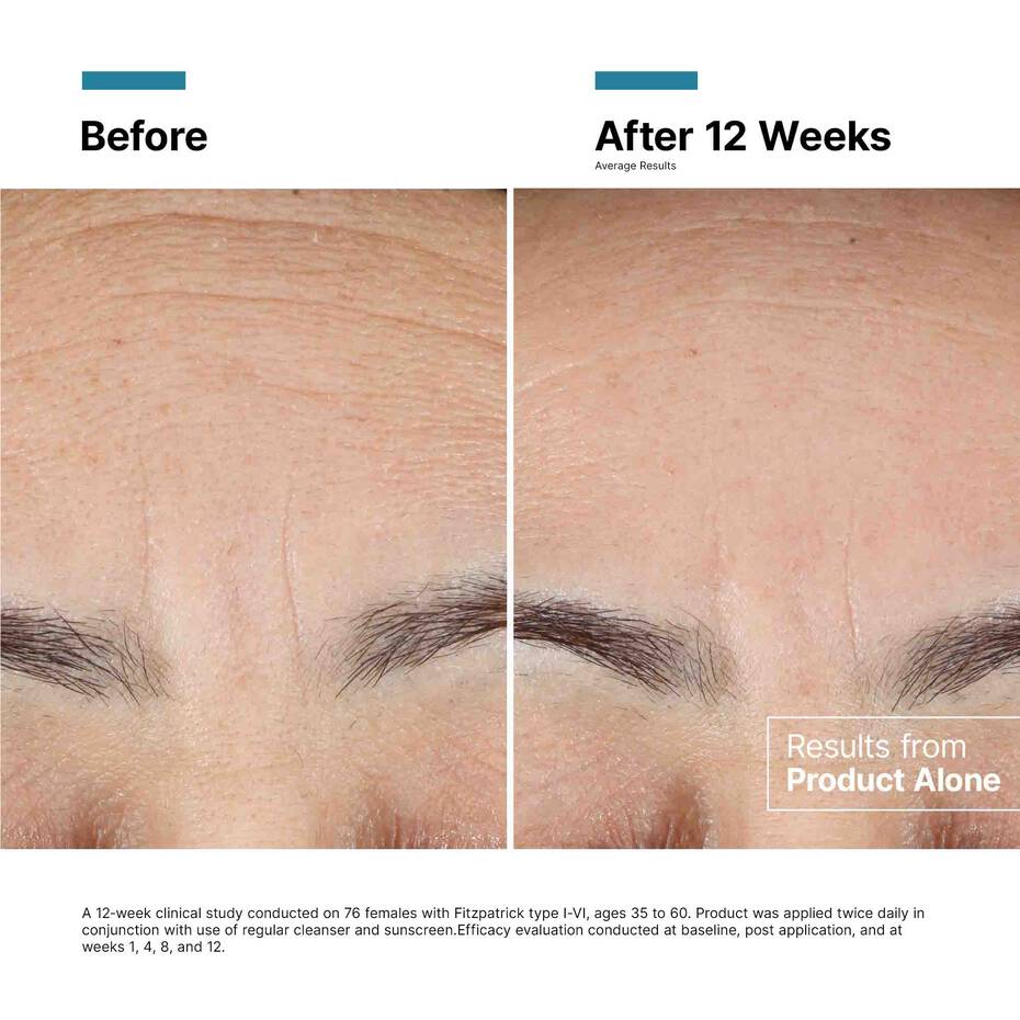 Clinical results after 12 weeks for SkinCeuticals Advanced RGN-6 showing improvement in six signs of aging.