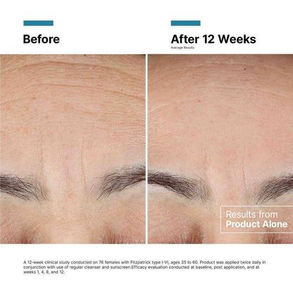 Clinical results after 12 weeks for SkinCeuticals Advanced RGN-6 showing improvement in six signs of aging.