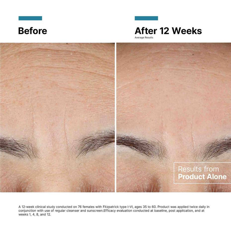 Clinical results after 12 weeks for SkinCeuticals Advanced RGN-6 showing improvement in six signs of aging.