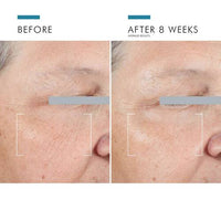 Before and After 8 Weeks Comparison of Skin with SkinCeuticals A.G.E. Advanced Eye Cream Showing Visible Improvement