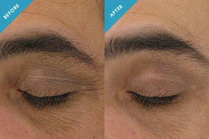SkinCeuticals- AOX + Eye Gel-The Skin Spot