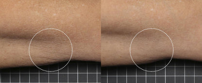 SkinMedica Firm & Tone Lotion before after arm result showing smoother crepey skin texture and improved body tone results now