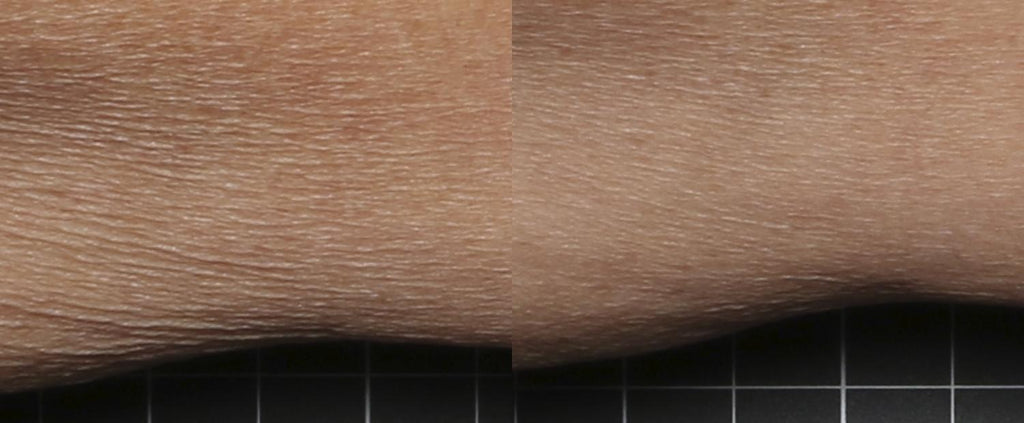 Before and after of SkinMedica Firm & Tone Lotion showing improved skin texture and firmness with reduced fine lines