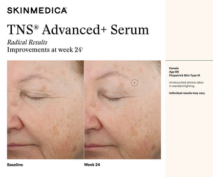 SkinMedica TNS Advanced+ Serum results at week 24 showing improved tone, smooth texture, and younger-looking skin after use.