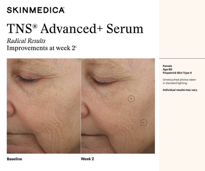 Before and after comparison of SkinMedica TNS Advanced+ Serum on a woman's face, showing improvements at week 2.