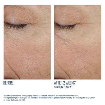 Before and after 2 weeks using SkinBetter Science Trio Rebalancing Moisture Treatment showing smoother hydrated skin