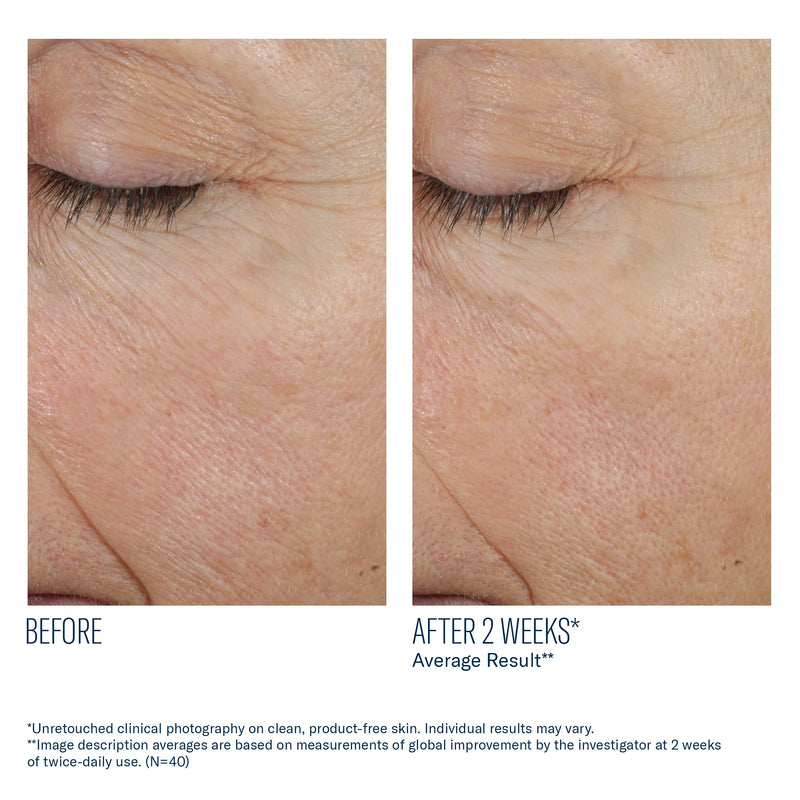Before and after 2 weeks using SkinBetter Science Trio Rebalancing Moisture Treatment showing smoother hydrated skin