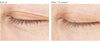  A.G.E. Eye Complex before and after