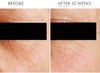  A.G.E. Eye Complex before and after