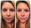 Alastin Skincare- Renewal Retinol before and after