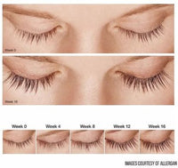 Allergan- Latisse before and after