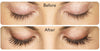 Allergan- Latisse before and after