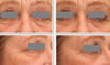 DefenAge- 3D Eye Radiance Cream before and after