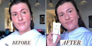 EltaMD- UV Daily SPF 40 Tinted before and after