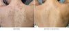 Environ Derma Lac Body Lotion before and after