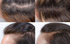 Nutrafol- Hair Growth Activator before and after