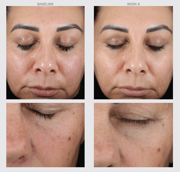 Retinol+ Skin Smoothing Brightening Cream-The Skin Spot