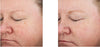 Revision Skincare- Retinol Complete 1.0 before and after