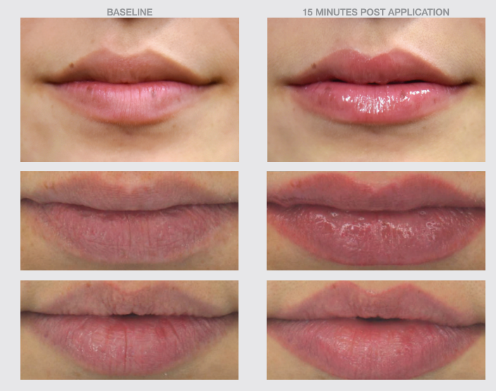 Lip Boost SPF30 Plumping Hydrating Serum