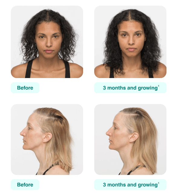 Nutrafol for women online reviews