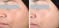 SkinCeuticals- Discoloration Defense before and after