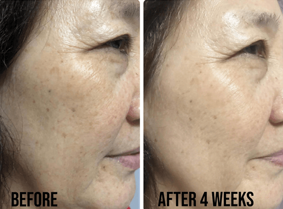 SkinCeuticals- Glycolic 10 Renew Overnight-The Skin Spot